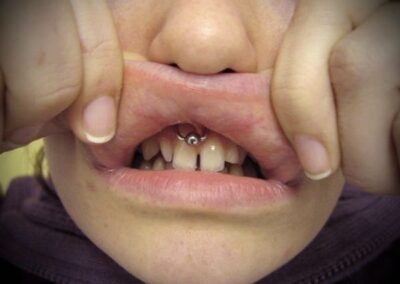 Smiley piercing at best tattoo shop